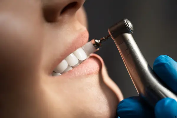 dental cleaning in Scarborough