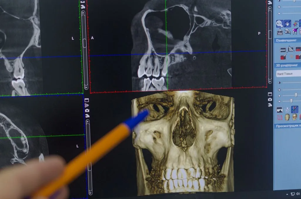 CBCT In Scarborough
